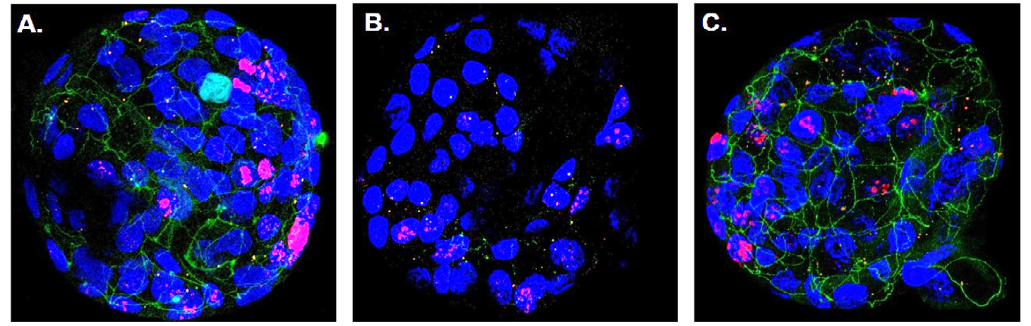 Spherical clusters of cells can be seen in three adjacent images against a black background.