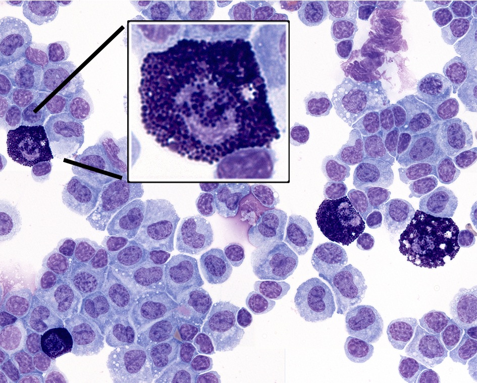 Тучные клетки фото под микроскопом