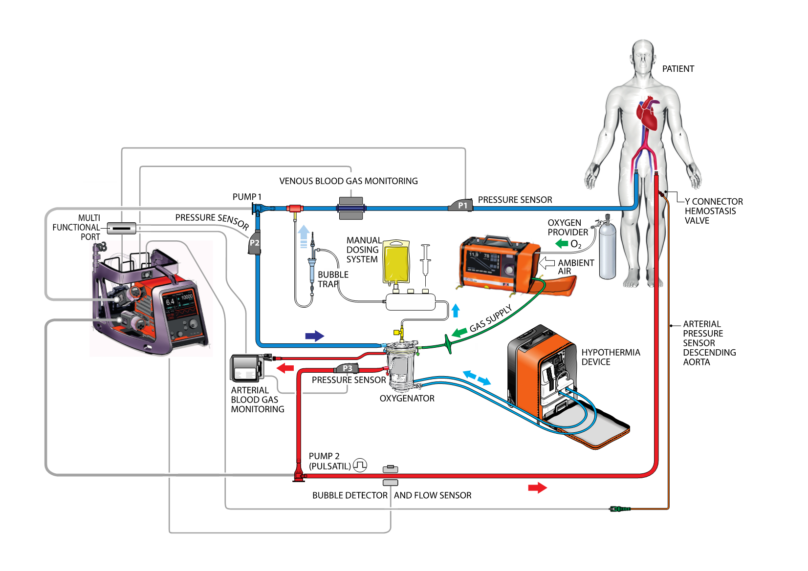 A drawing shows which devices are used where in the extracorporeal circuit.