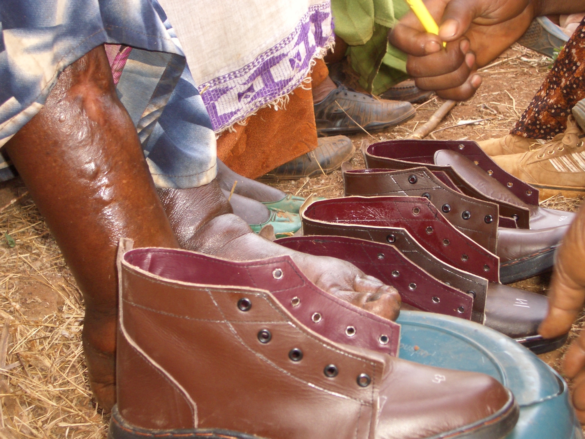 Auf dem Bild ist eine Reihe aus festem Schuhwerk zu sehen. Vor den Schuhen sitzen Personen, von denen nur die Beine und Füße zu sehen sind, die teilweise ödematös angeschwollen sind. Der Untergrund, auf dem die Schuhe stehen, ist sandig und teilweise von