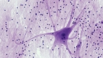 Microscope image of a motoneuron of the spinal cord (colored purple)