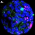 Teaser_Organoids_Kosinsky_IT-Lymphozyten_Angriffspunkt_bei_Morbus_Crohn.jpg